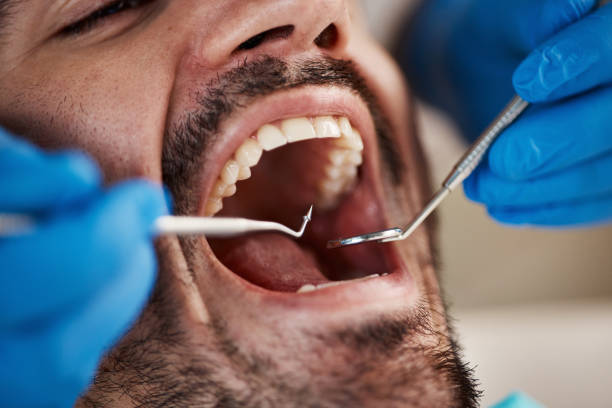 Emergency Dental Services in Saranap, CA